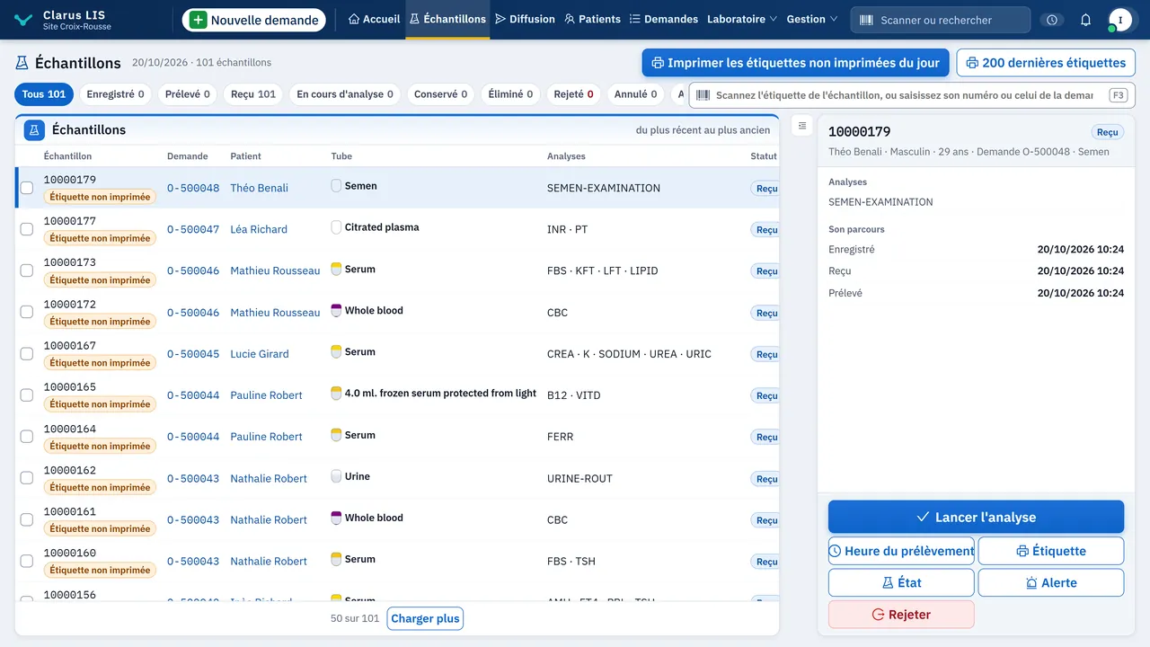 Écran de liste de travail de Clarus LIS pour le suivi des échantillons